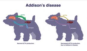 Addison's